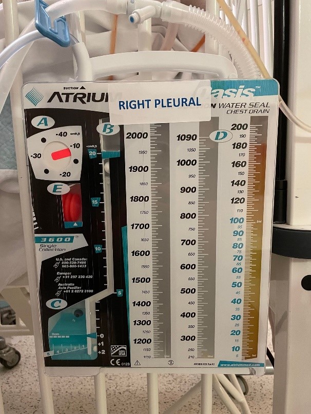 right pleural_chest drain managments